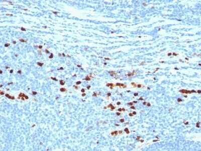 Immunohistochemistry-Paraffin: S100A9 Antibody (MAC387) [NBP2-45295]