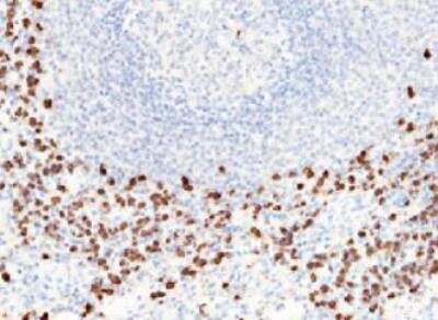 Immunohistochemistry-Paraffin: S100A8 Antibody (101) [NBP2-89805]