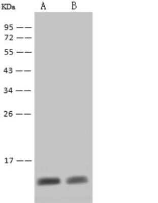 Western Blot: S100A8 Antibody (203) [NBP2-89806]