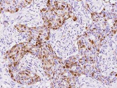 Immunohistochemistry-Paraffin: S100A8 Antibody (216) [NBP2-89808]