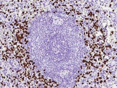 Immunohistochemistry-Paraffin: S100A8 Antibody (216) [NBP2-89808]