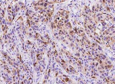 Immunohistochemistry-Paraffin: S100A8 Antibody (236) [NBP2-89809]