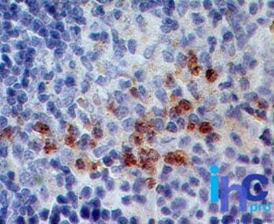 Immunohistochemistry-Paraffin: S100A8 Antibody (63N13G5) - BSA Free [NBP2-27067]