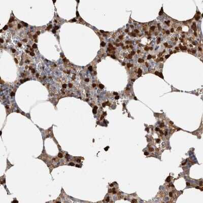 Immunohistochemistry-Paraffin: S100A8 Antibody [NBP1-90314]