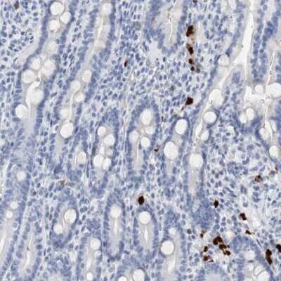 Immunohistochemistry-Paraffin: S100A8 Antibody [NBP1-90314]