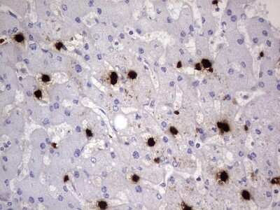 Immunohistochemistry: S100A9 Antibody (OTI10D5) [NBP2-45662]