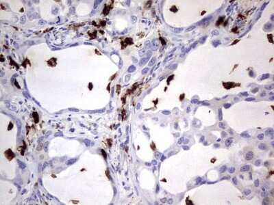 Immunohistochemistry: S100A9 Antibody (OTI10D5) [NBP2-45662]