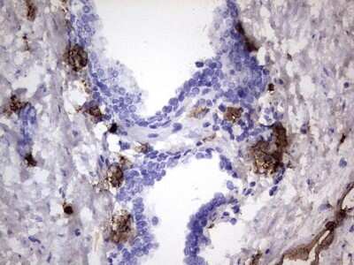 Immunohistochemistry: S100A9 Antibody (OTI10D5) [NBP2-45662]