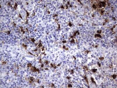 Immunohistochemistry: S100A9 Antibody (OTI10D5) [NBP2-45662]