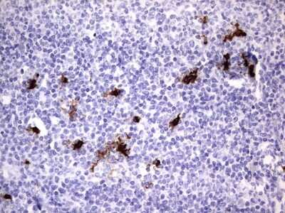 Immunohistochemistry: S100A9 Antibody (OTI10D5) [NBP2-45662]