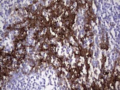 Immunohistochemistry: S100A9 Antibody (OTI10D5) [NBP2-45662]