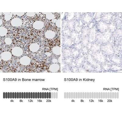 Immunohistochemistry-Paraffin: S100A9 Antibody (CL11191) [NBP3-07983]