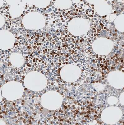 Immunohistochemistry-Paraffin: S100A9 Antibody (CL11191) [NBP3-07983]