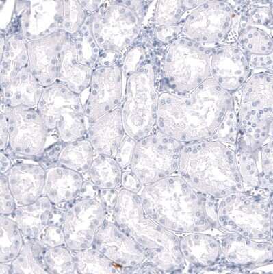 Immunohistochemistry-Paraffin: S100A9 Antibody (CL11191) [NBP3-07983]