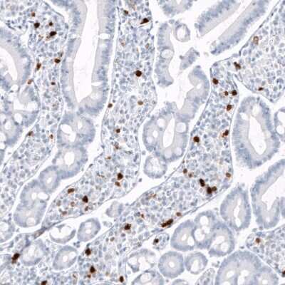 Immunohistochemistry-Paraffin: S100A9 Antibody (CL11191) [NBP3-07983]