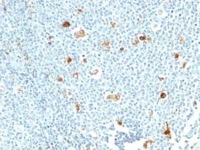 Immunohistochemistry-Paraffin: S100A9 Antibody (CPT/1028) [NBP2-44912]