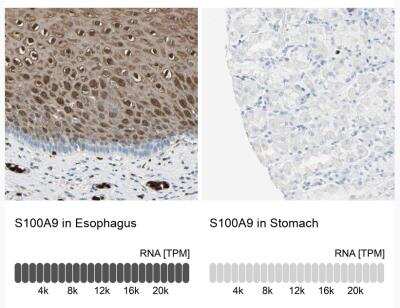 Immunohistochemistry-Paraffin: S100A9 Antibody [NBP1-89360]