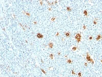 Immunohistochemistry-Paraffin: S100A9 Antibody (MRP14/840) [NBP2-45292]