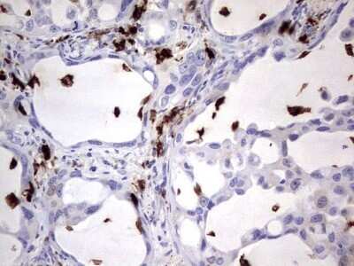 Immunohistochemistry: S100A9 Antibody (OTI10D5) - Azide and BSA Free [NBP2-73970]