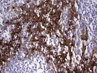 Immunohistochemistry: S100A9 Antibody (OTI10D5) - Azide and BSA Free [NBP2-73970]