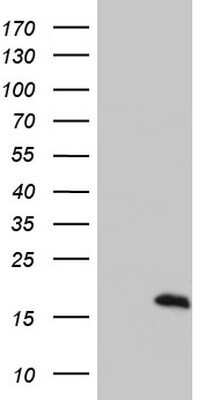 Western Blot: S100A9 Antibody (OTI10D5)Azide and BSA Free [NBP2-73970]