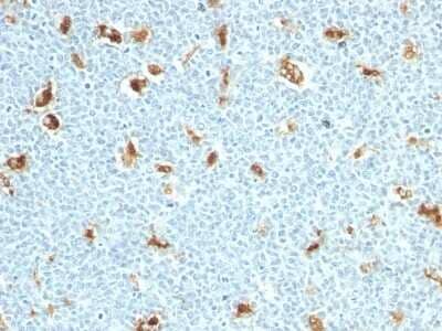 Immunohistochemistry-Paraffin: S100A9 Antibody (S100A9/1011) [NBP2-44910]