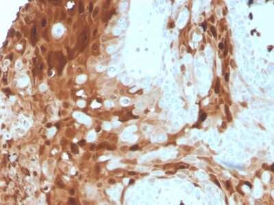 Immunohistochemistry-Paraffin: S100A9 Antibody (S100A9/1075) [NBP2-44913]