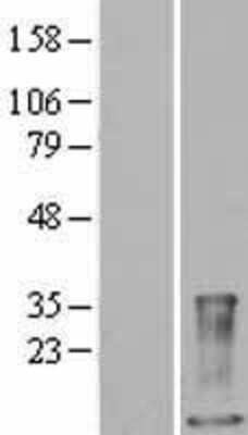 Western Blot: S100A9 Overexpression Lysate [NBL1-15660]