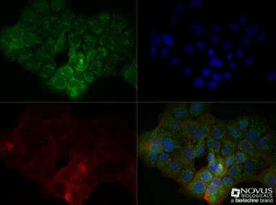 Immunocytochemistry/ Immunofluorescence: S100B Antibody (15F4NB) - Azide and BSA Free [NBP2-45225]