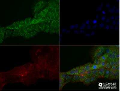 Immunocytochemistry/ Immunofluorescence: S100B Antibody (15F4NB) - Azide and BSA Free [NBP2-45225]