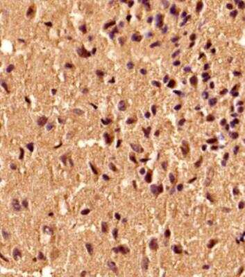 Immunohistochemistry-Paraffin: S100B Antibody (15F4NB) - Azide and BSA Free [NBP2-45225]