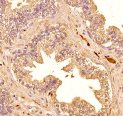 Immunohistochemistry-Paraffin: S100B Antibody (15F4NB) - Azide and BSA Free [NBP2-45225]