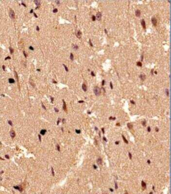 Immunohistochemistry-Paraffin: S100B Antibody (15F4NB) - Azide and BSA Free [NBP2-45225]