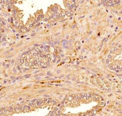 Immunohistochemistry-Paraffin: S100B Antibody (15F4NB) - Azide and BSA Free [NBP2-45225]