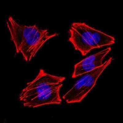 Immunocytochemistry/ Immunofluorescence: S100B Antibody (4C4.9 + S100B/1012) [NBP2-53187]