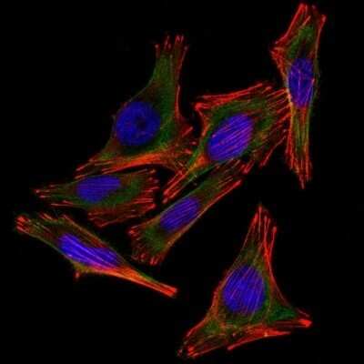 Immunocytochemistry/ Immunofluorescence: S100B Antibody (4C4.9 + S100B/1012) - Azide and BSA Free [NBP2-54559]