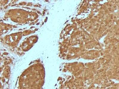 Immunohistochemistry-Paraffin: S100B Antibody (4C4.9 + S100B/1012) - Azide and BSA Free [NBP2-54559]