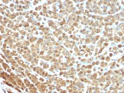 Immunohistochemistry-Paraffin: S100B Antibody (4C4.9) - IHC-Prediluted [NBP2-44590]