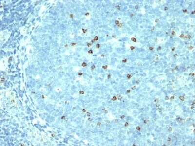 Immunohistochemistry-Paraffin: S100B Antibody (4C4.9) [NBP2-29403]