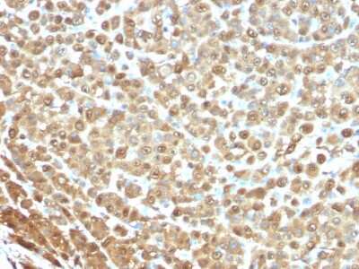 Immunohistochemistry-Paraffin: S100B Antibody (4C4.9) [NBP2-29403]