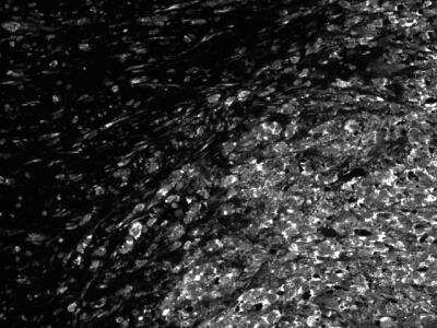 Immunohistochemistry-Paraffin: S100B Antibody (4C4.9) [NBP2-29403]