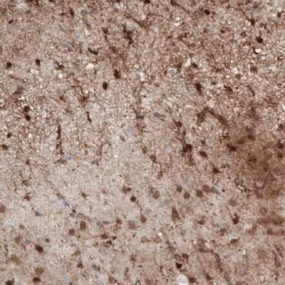 Immunohistochemistry-Paraffin: S100B Antibody (CL2720) [NBP2-46626]