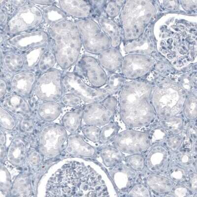 Immunohistochemistry-Paraffin: S100B Antibody (CL2720) [NBP2-46626]