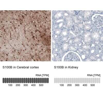 Immunohistochemistry-Paraffin: S100B Antibody (CL2720) [NBP2-46626]