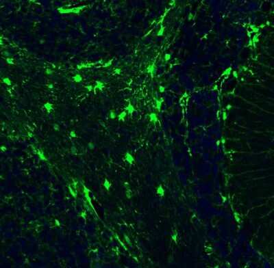 Immunohistochemistry: S100B Antibody (CL2720) [NBP2-46626]