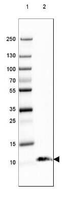 Western Blot: S100B Antibody (CL2720) [NBP2-46626]