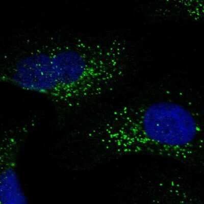 Immunocytochemistry/ Immunofluorescence: S100B Antibody [NBP1-87102]