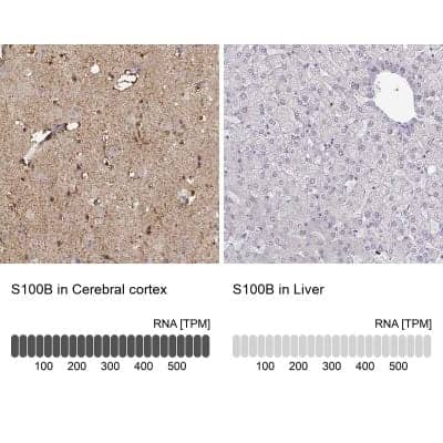 Immunohistochemistry-Paraffin: S100B Antibody [NBP1-87102]