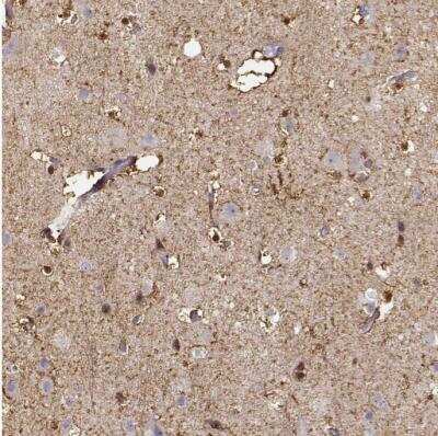 Immunohistochemistry-Paraffin: S100B Antibody [NBP1-87102]