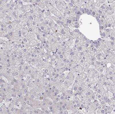 Immunohistochemistry-Paraffin: S100B Antibody [NBP1-87102]